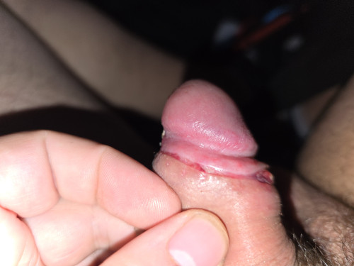 1000026271
