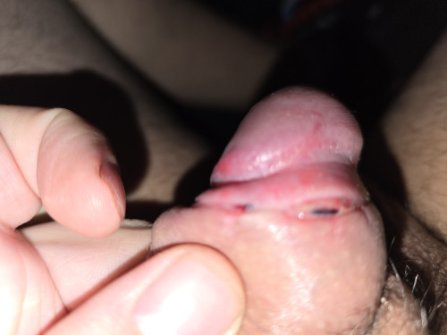 1000026274