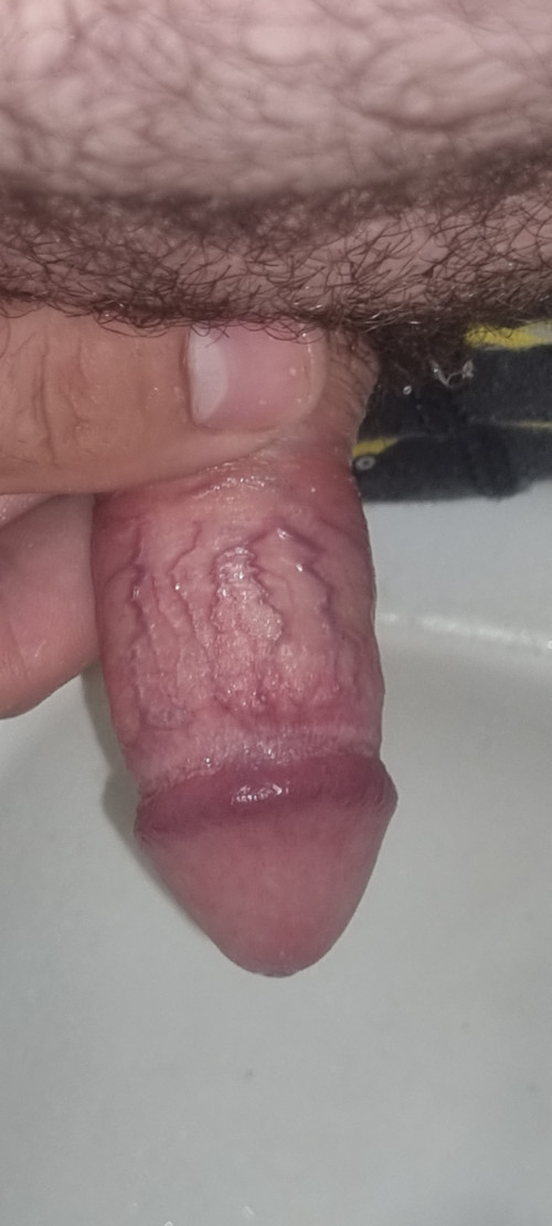1000011581