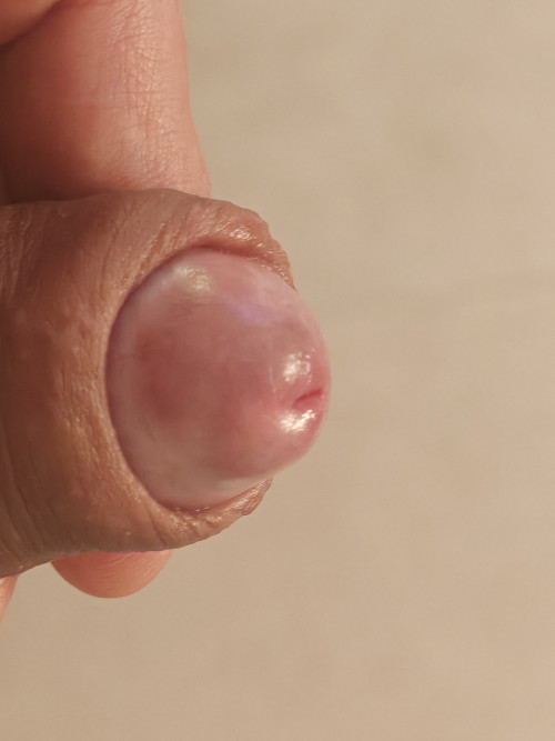 1000081464
