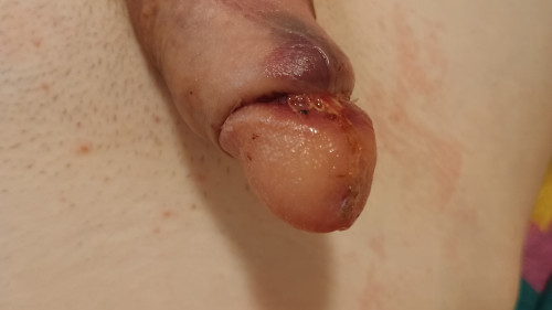 IMG 20241204 111350595