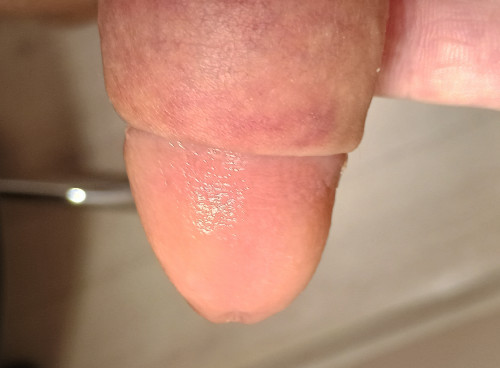IMG 20241205 103528001 HDR~2