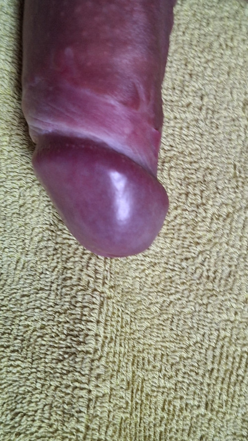 1000044093
