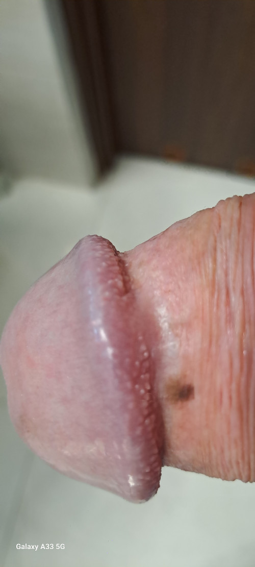 1000015192