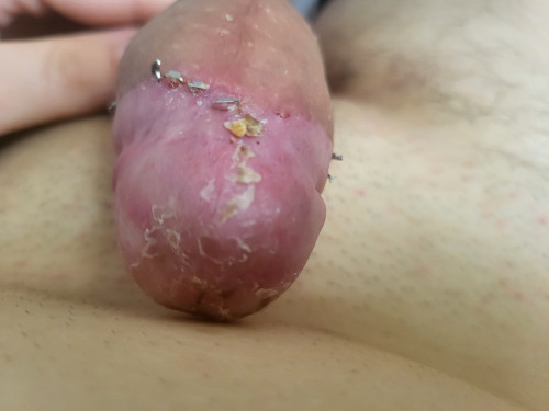 1000005873