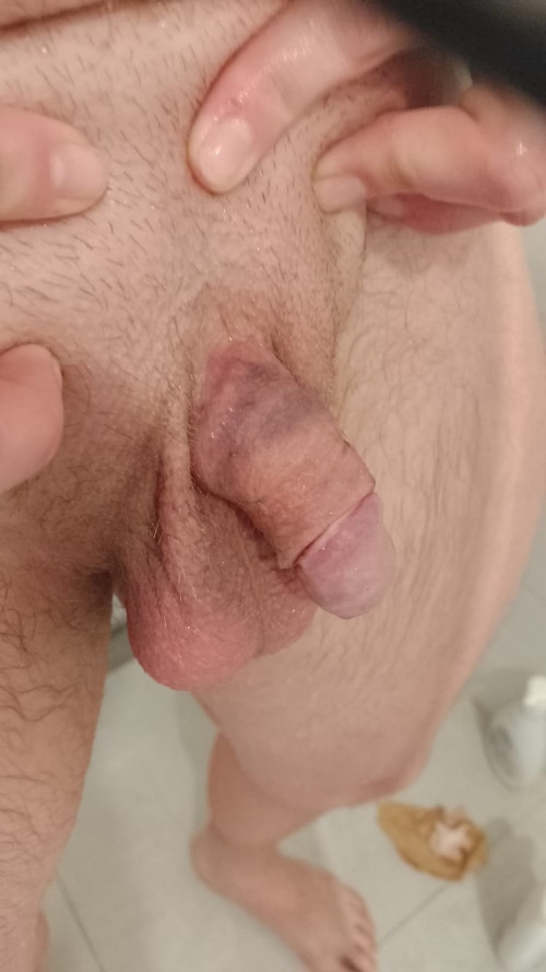 1000001084