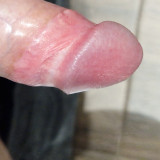 1000005680