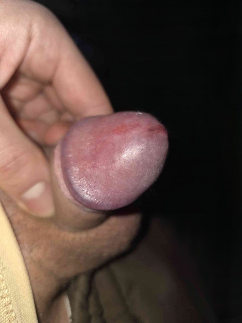 20260206 122640
