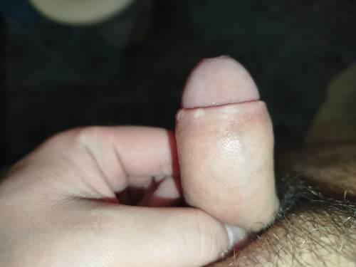1000006887