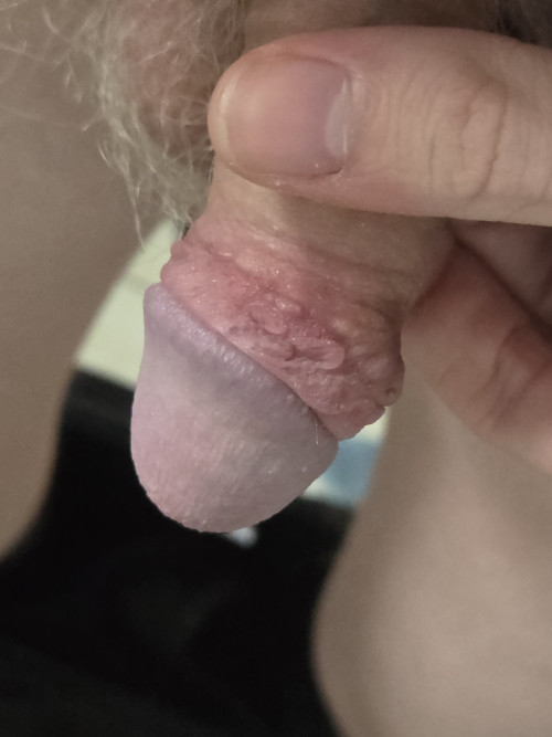 20260321 151533