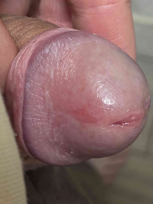 20260331 214956