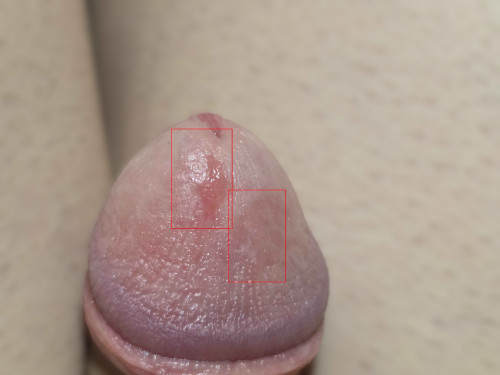 20260422 210156